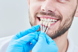 dental implants