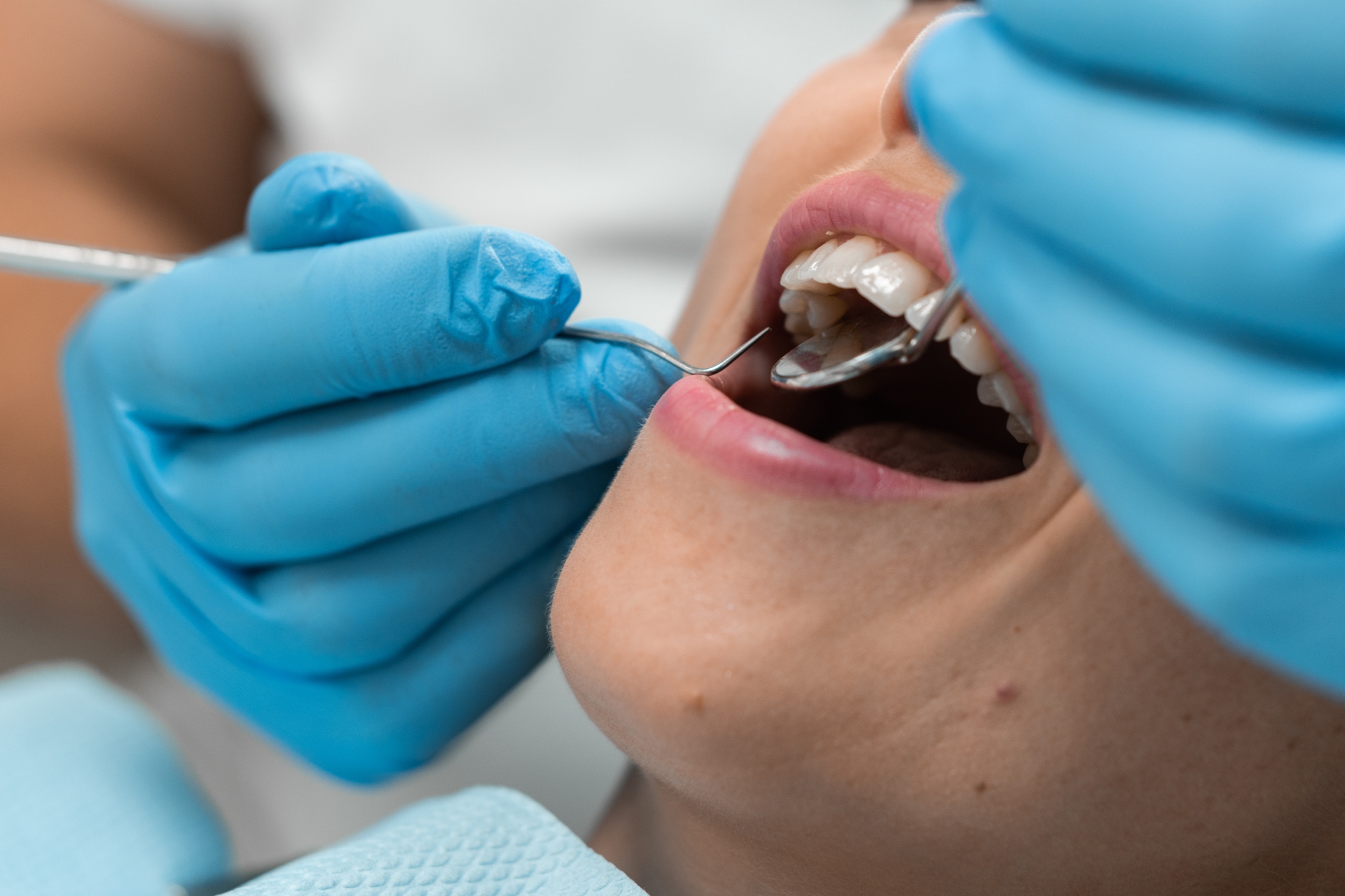 Dental Checkup